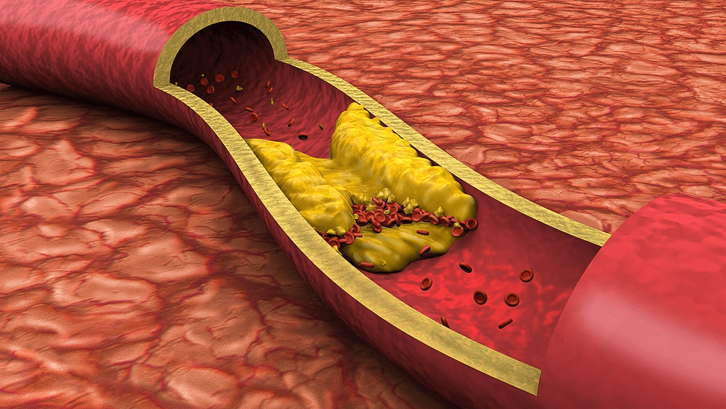 cholesterol levels