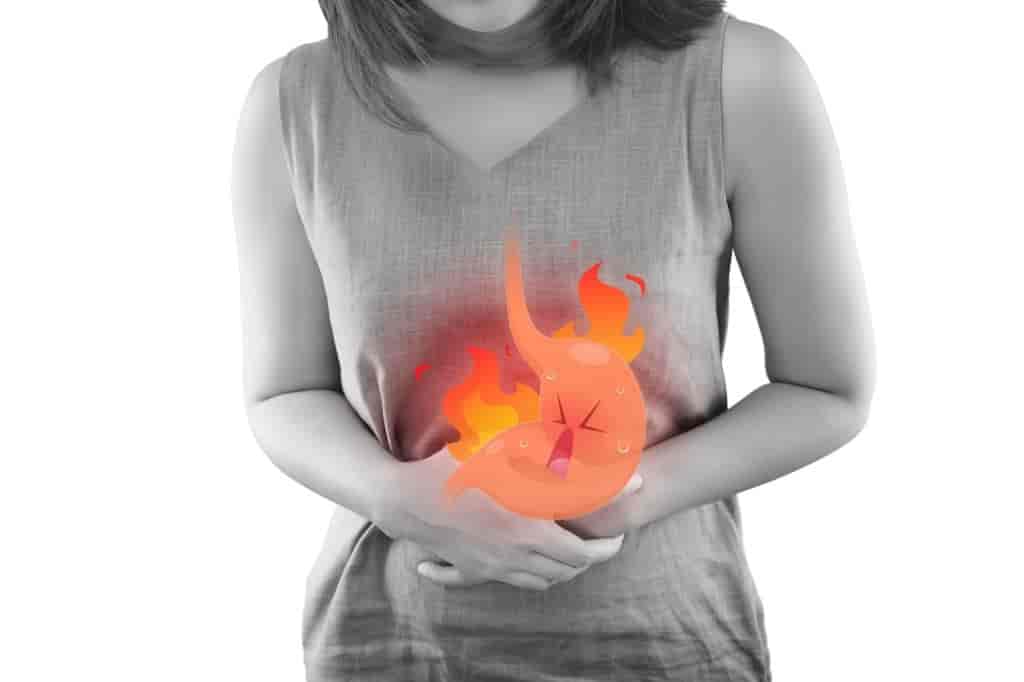 10 Natural Remedies for Heartburn & Severe Acid Reflux