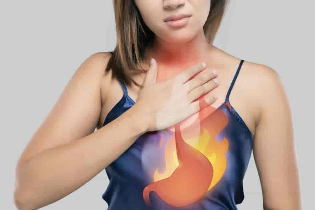 Regurgitation & Heartburn