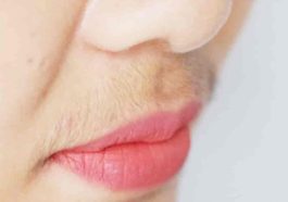 hair laser removal